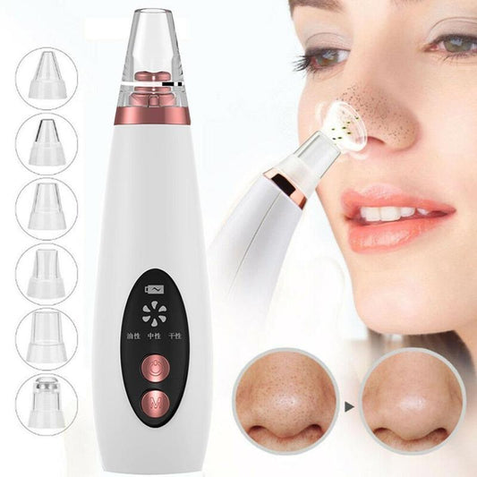 Blackhead Acne Removal Button Face Suction Beauty Skin Care Tool with interchangeable tips and suction feature for skin care.